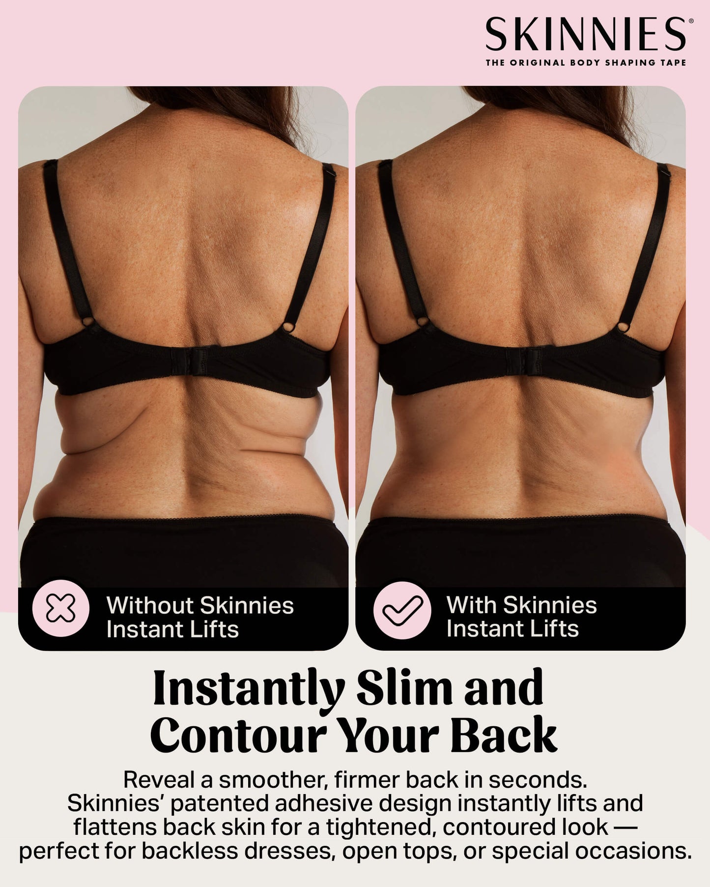 Cinta de levantamiento de espalda instantánea Skinnies