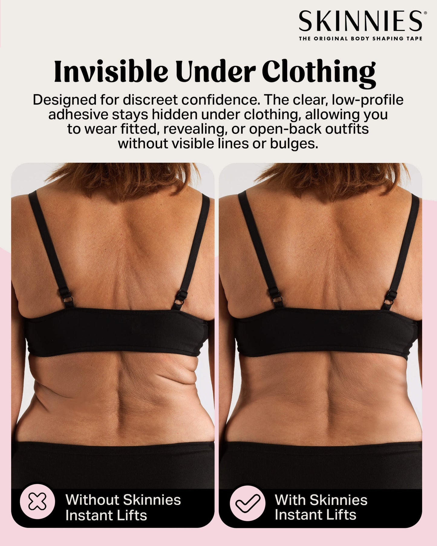 Cinta de levantamiento de espalda instantánea Skinnies