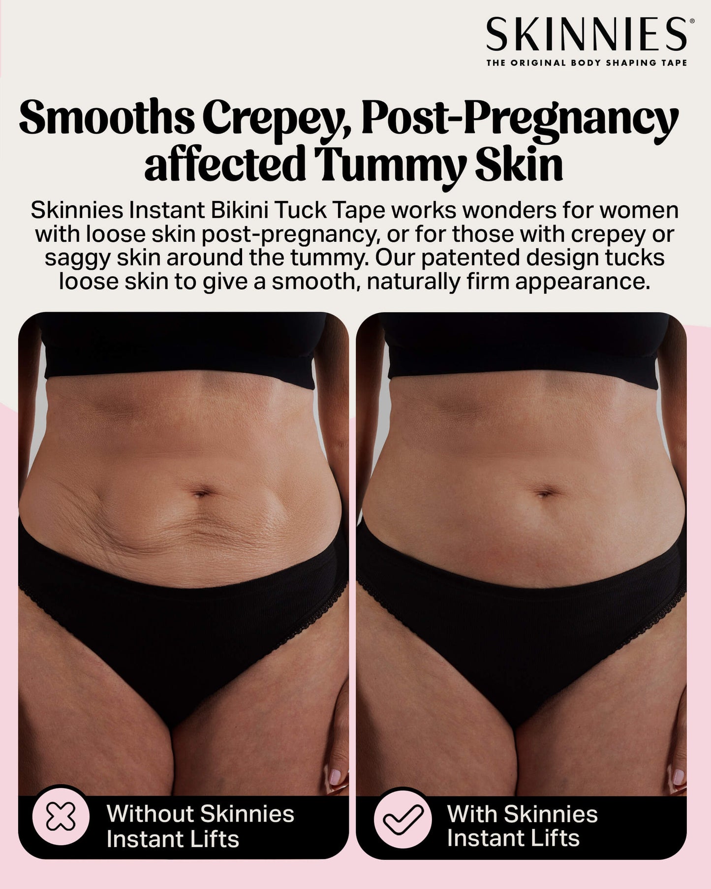 Cinta para el pliegue instantáneo del bikini de Skinnies