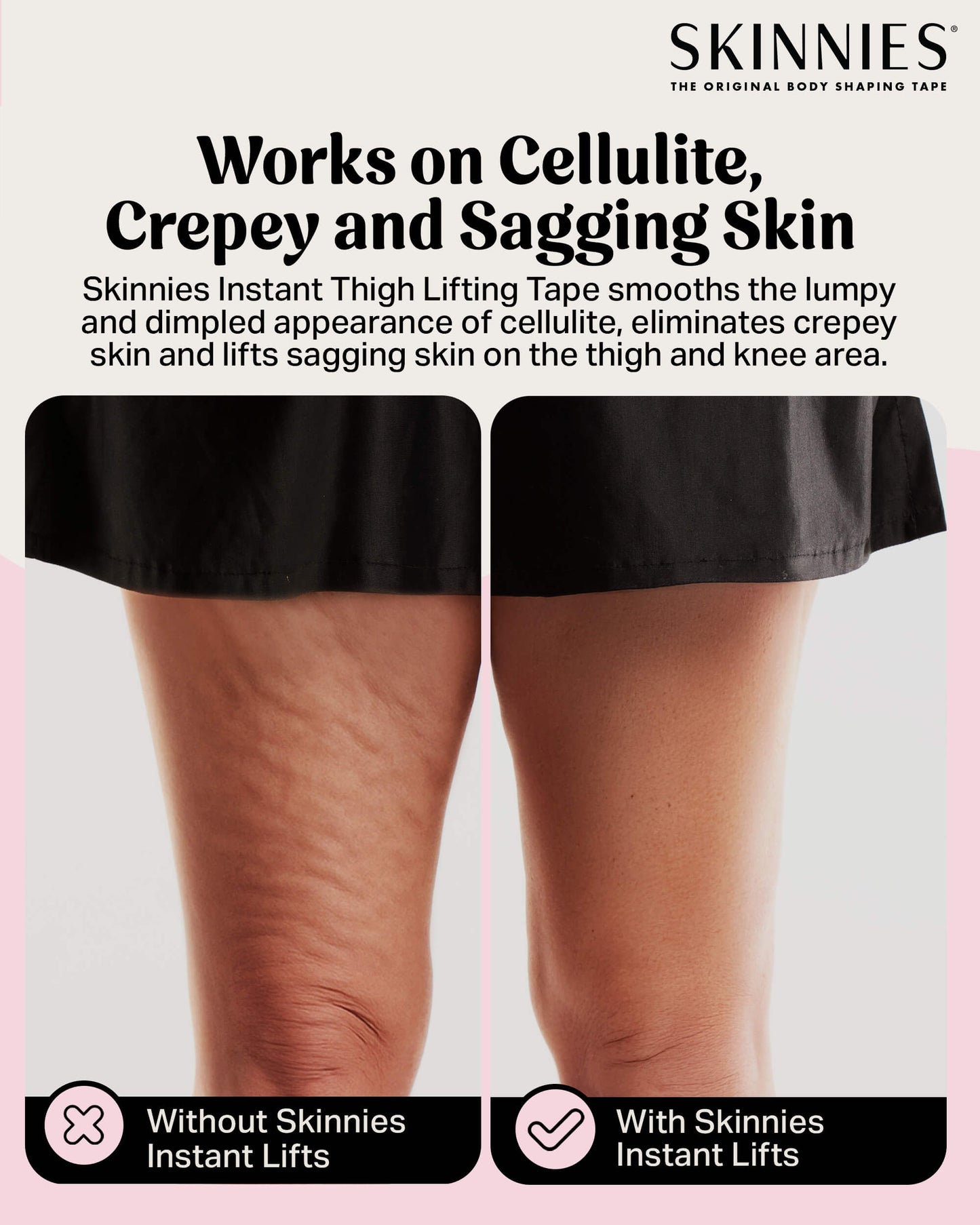 Cinta de levantamiento instantáneo de muslos Skinnies