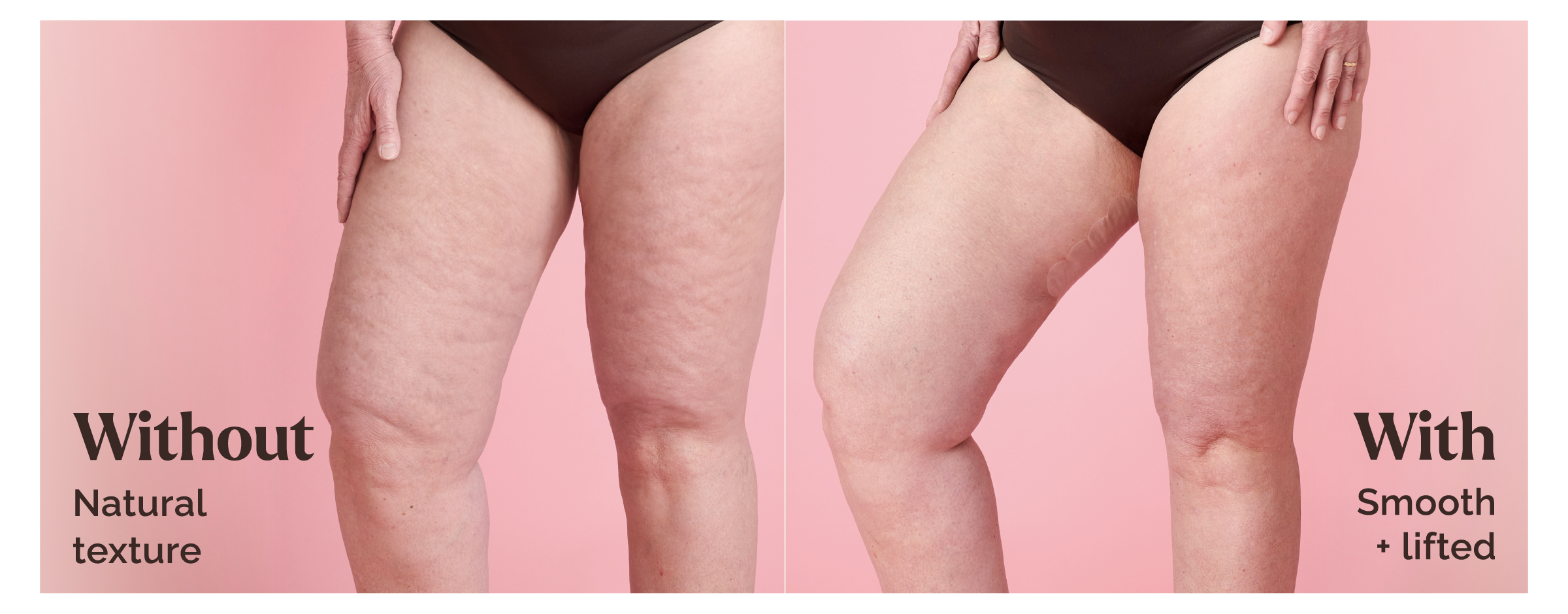 Skinnies Instant Inner Thigh Shaping Tape results